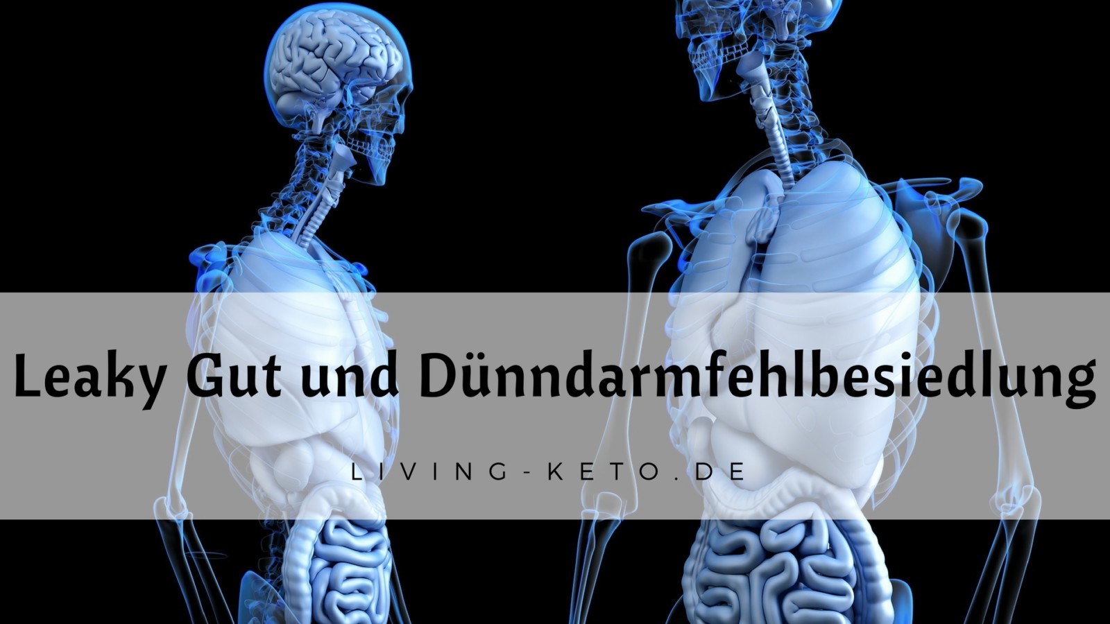 Du betrachtest gerade Leaky Gut und Dünndarmfehlbesiedlung: Ein umfassender Leitfaden