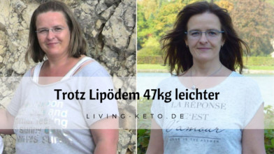 Mehr über den Artikel erfahren Abnehmen mit Lipödem: 47 kg abgenommen – Mein Weg zu einem leichteren Leben